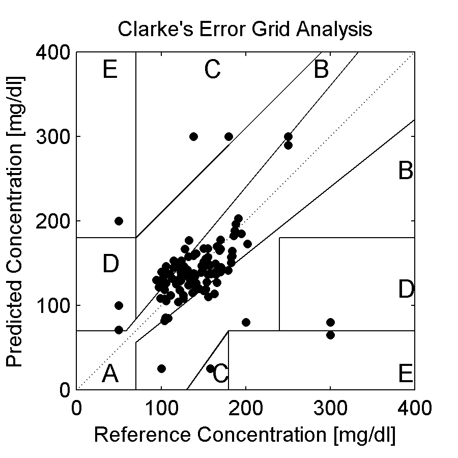 error grid analysis software